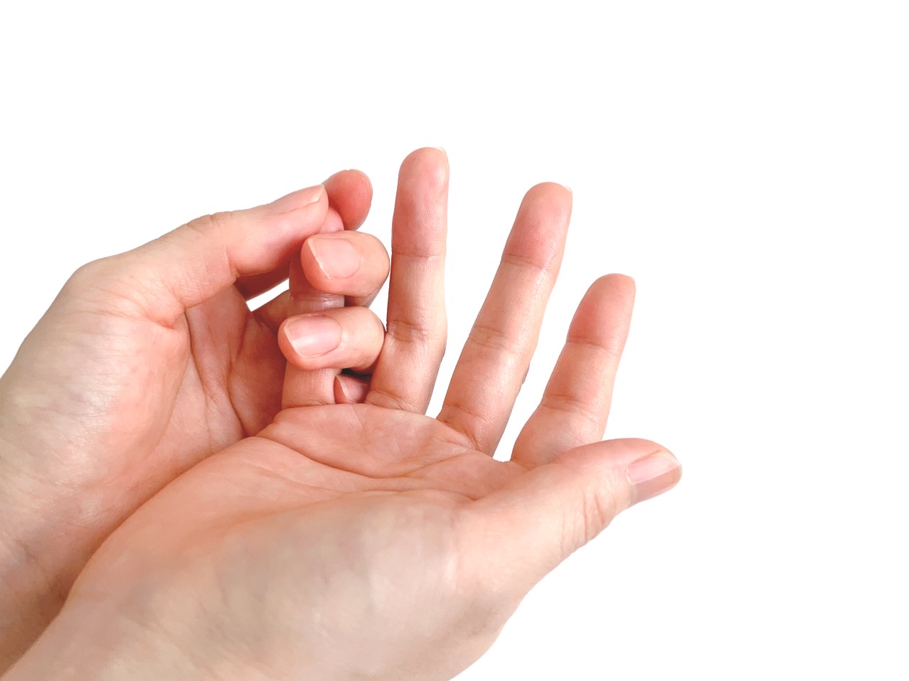 ばね指症例イメージ1
